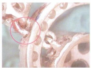 Le matériau de soudage n'a pas pénétré à l'intérieur du cordon de soudure pendant le soudage, ce qui a entraîné une fusion incomplète, comme le montre la figure 7-H.