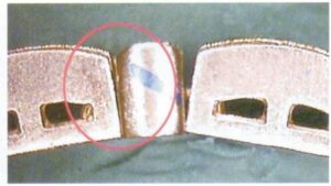 Soudés pour être inamovibles, comme le montre la figure 7-18