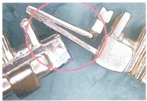 Il y a un mauvais ajustement entre le fermoir à languette de la figure 7-21 et le fermoir à languette de la figure 7-21.