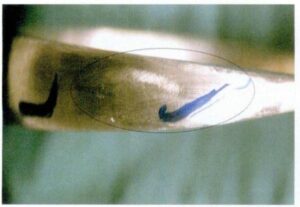 Figure 7-29 Blessure au niveau de la tige de l'anneau lors de l'archivage pour le support de coulée