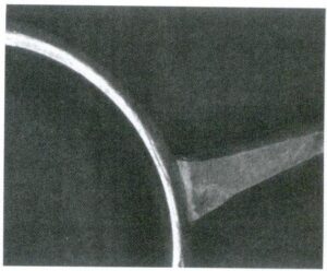 リングの内側のリングには、インナーアークが必要である。