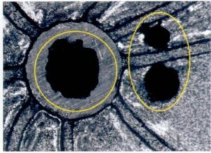 マスターモールドは崩れ、穴のエッジが欠けている。