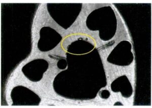 マスターモールドの表面に砂穴が開く