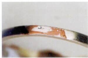 Figure 6-28 925 A silver ring has shrinkage at the root of the waterline.