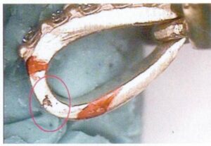 Figure 6-38 18 Irregular large sand holes appeared on the side surface of melon seeds