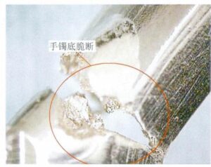 Figure 6-44 The brittle fracture of the ring is due to metal dust flying during the mold making process, some of which adheres to the wax mold and then transfers to the gold after casting.