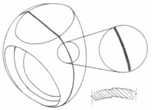 Improper position of the parting surface in Figure 6-1.