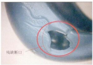 Figure 6-18 When there are defects such as defects, cold gaps, and flow marks on the wax mold, defects of the defect class will appear.