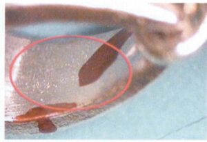 9-48 Слабая усадка на внутренней стенке залога.