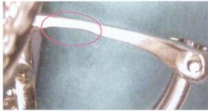 Рисунок 9-62 слишком тонкий опорный столбик серьги