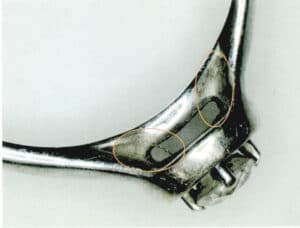 الشكل 7-28 الأوساخ الملتصقة بشقوق المجوهرات