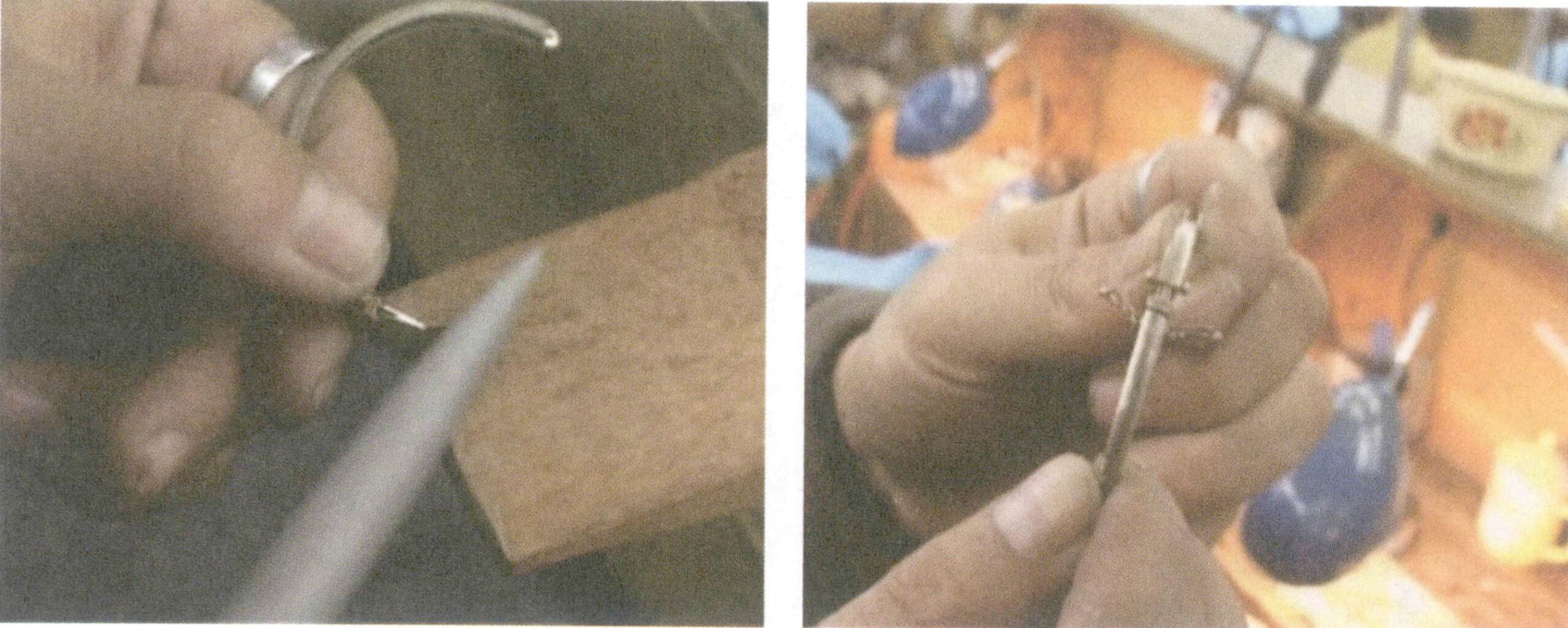 Figure 4-13 Clasp Adjustment