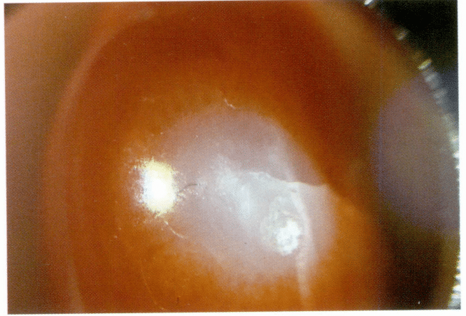 Рисунок 3-4-11 Белая сердцевина, трещины и паутинообразная структура в поперечном разрезе коралла AKA