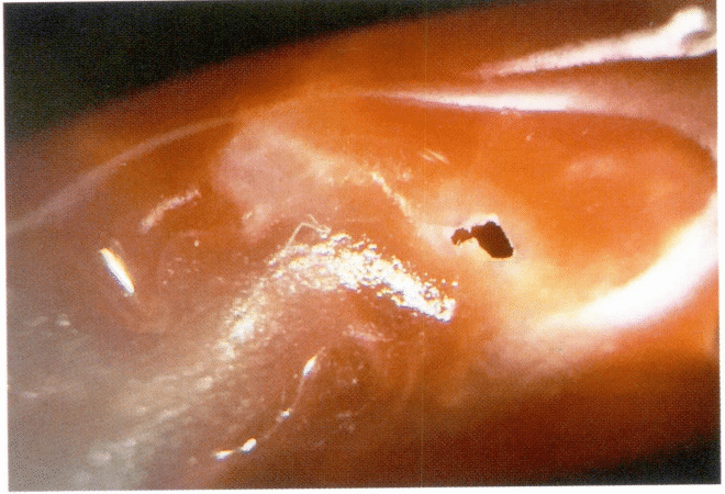 Рисунок 3-4-12 Отверстия и неравномерный цвет продольного среза коралла AKA