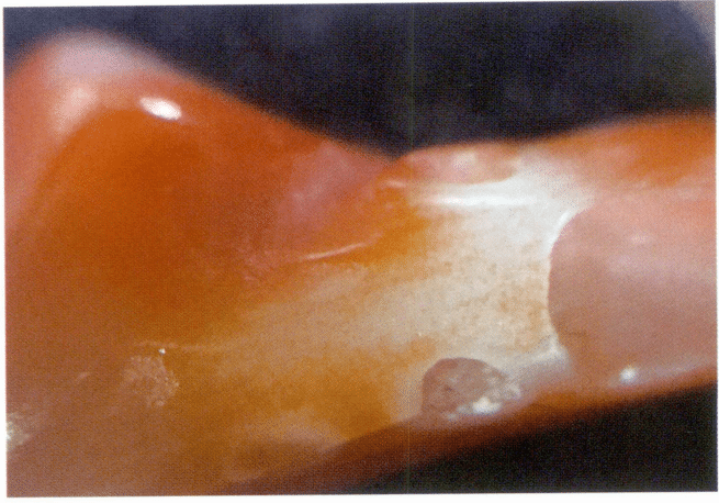 Рисунок 3-4-14 Отверстия, трещины и неравномерный цвет на поверхности коралла AKA (2)