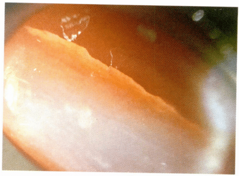 Рисунок 3-4-15 Волнистые узоры и трещины на продольном разрезе коралла AKA