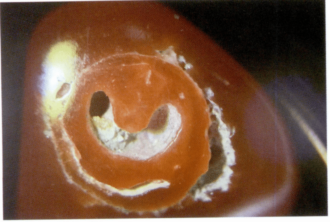 Рисунок 3-4-9 Круговое расщепление в поперечном сечении коралла ака (i)
