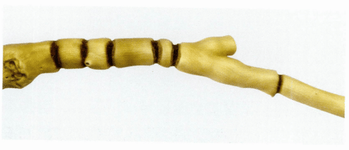 Рисунок 3-5-9 Сочлененные ветви морского бамбука