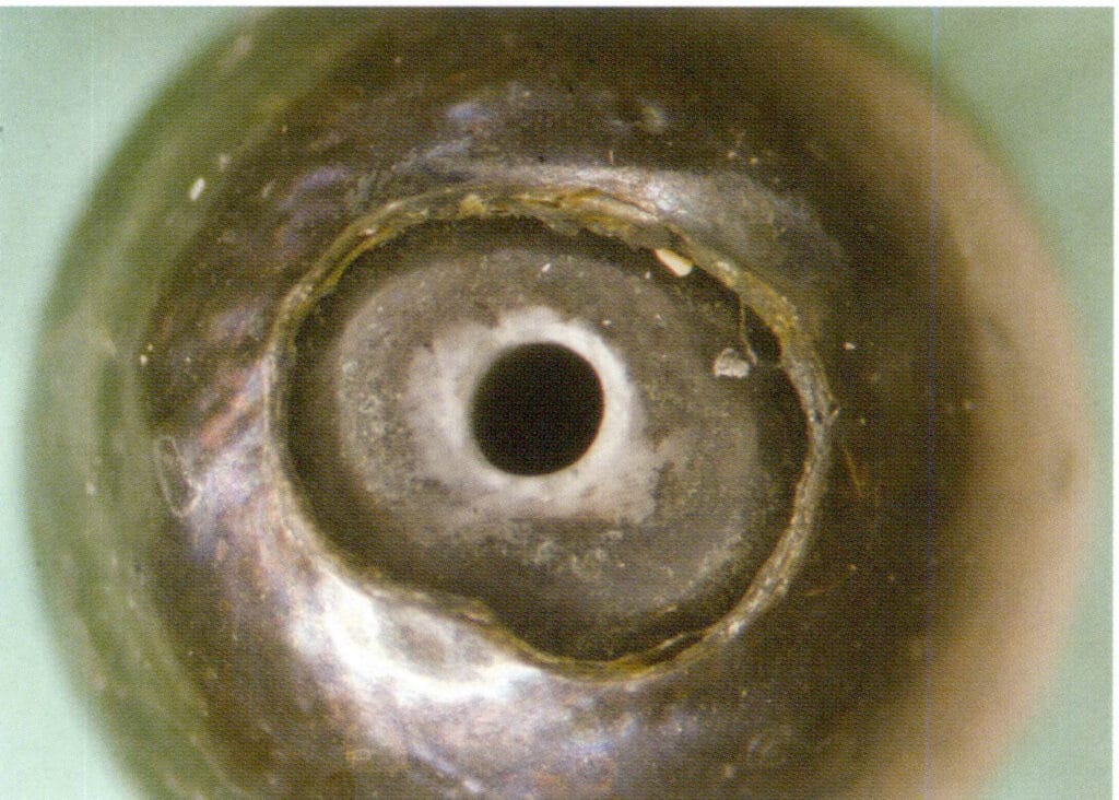 Figure 1-5-60 Characteristics of the drilling area of dyed seawater cultured pearls (under a microscope)