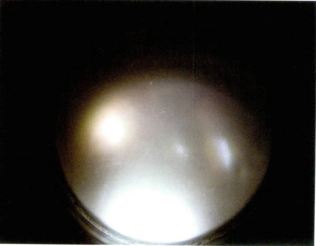Figure 1-5-71 Irradiated freshwater cultured pearls (under microscope)