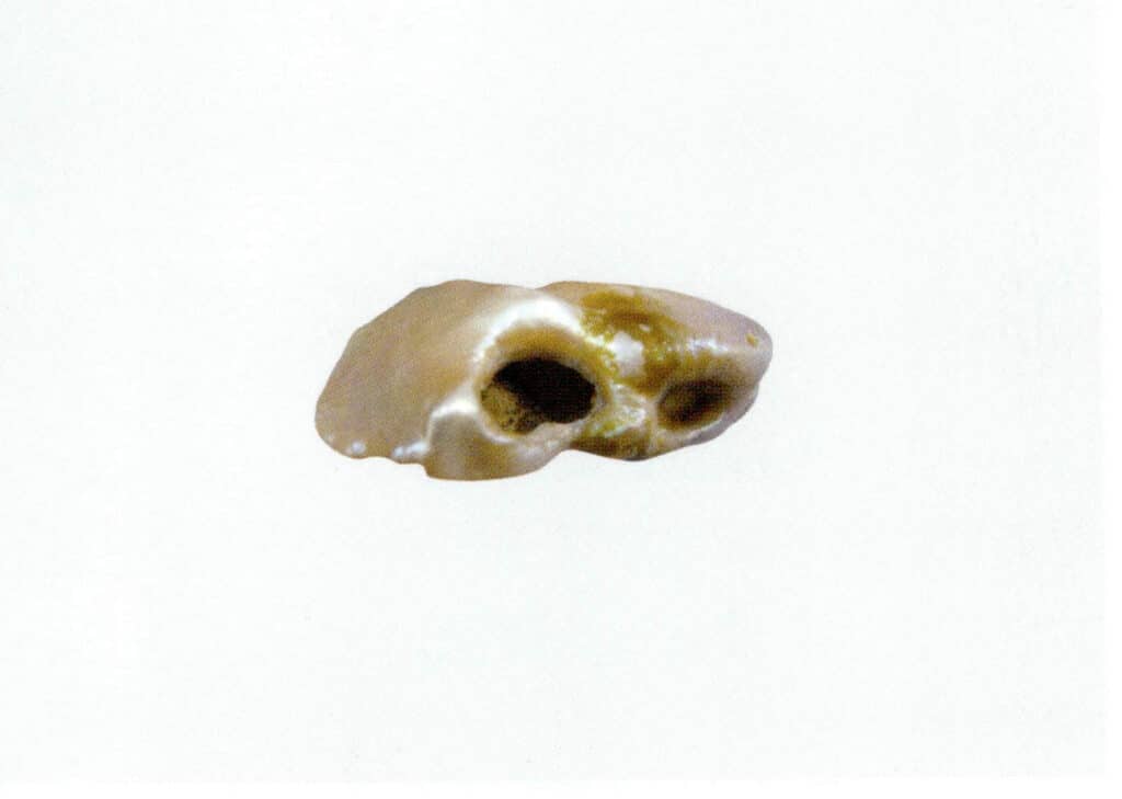 Figure 1-5-78 Pearls with holes awaiting treatment