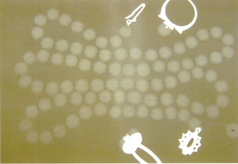 Figure 1-6-19 X-ray observation of pearl jewelry