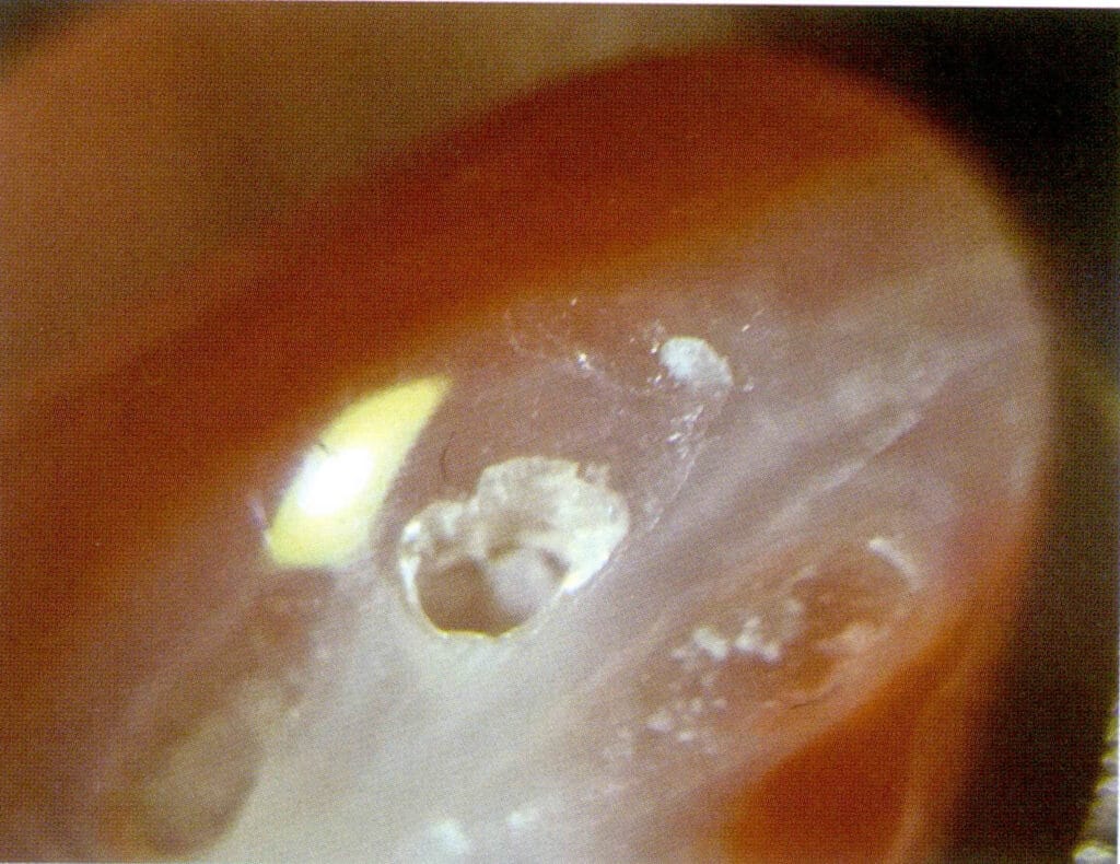 Рисунок 3-4-6 Белая сердцевина коралла ака