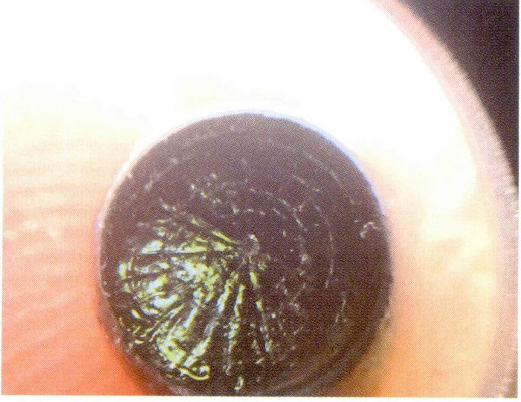 Рисунок 3-4-43 Паутинообразная структура поперечного сечения черного коралла