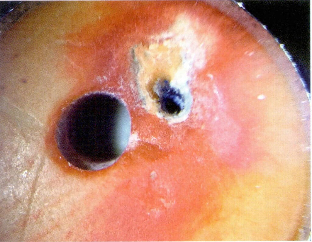 Рисунок 3-5-14 Цвет окрашенного морского бамбука обогащается в просверленных отверстиях и ямах
