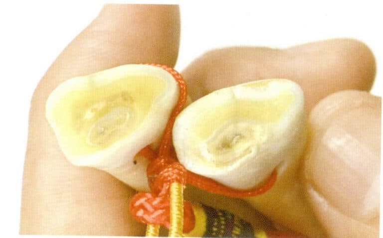 Figure 4-5-15 The cross-section of a wild boar's tooth