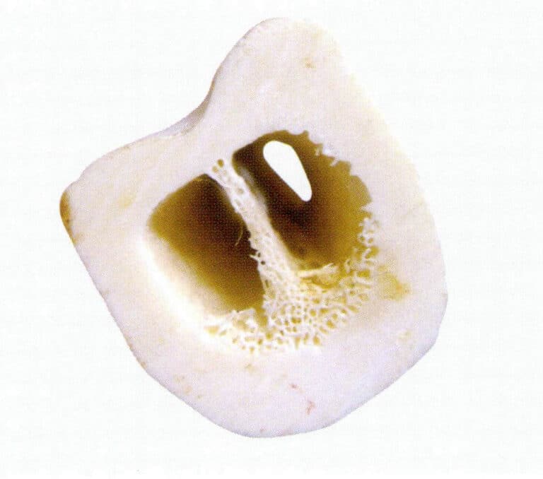 Figure 4-5-18 Cross-section of a bone