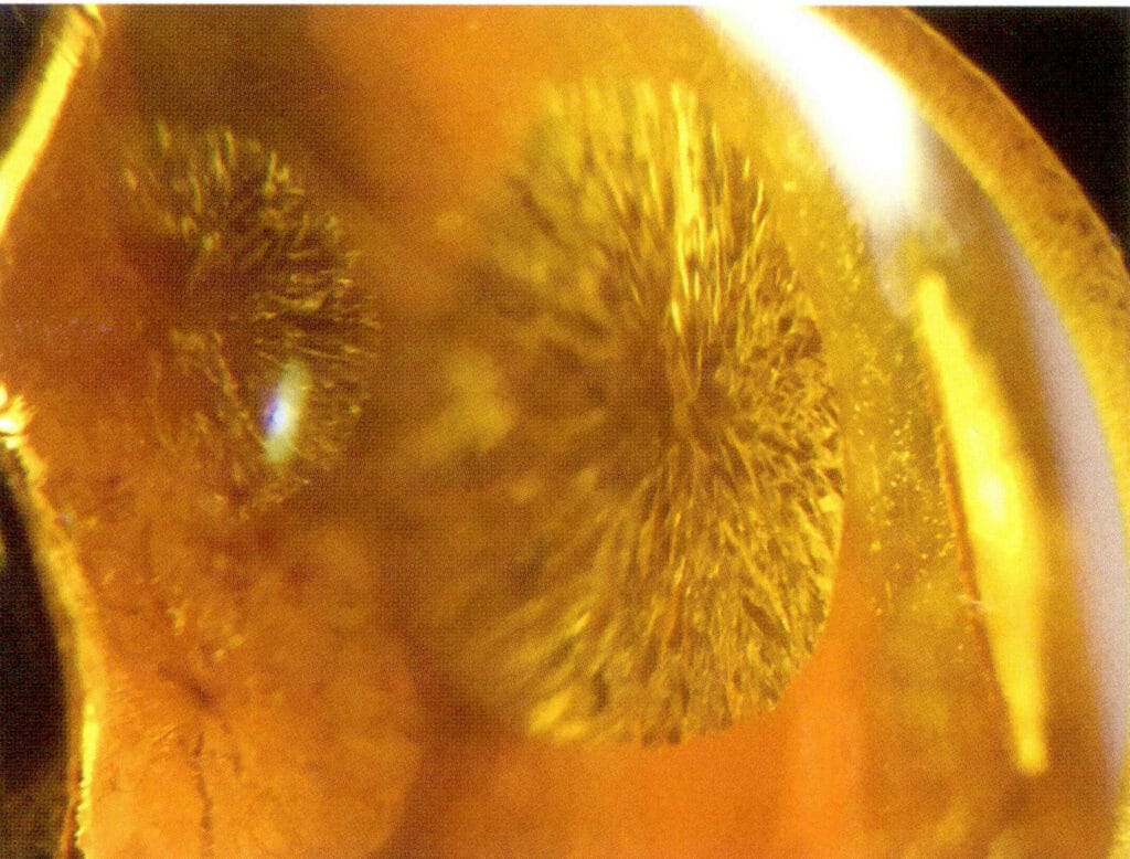 Figure5-5-14 "Sunshine" in Gold Flower Amber (20x) (I)