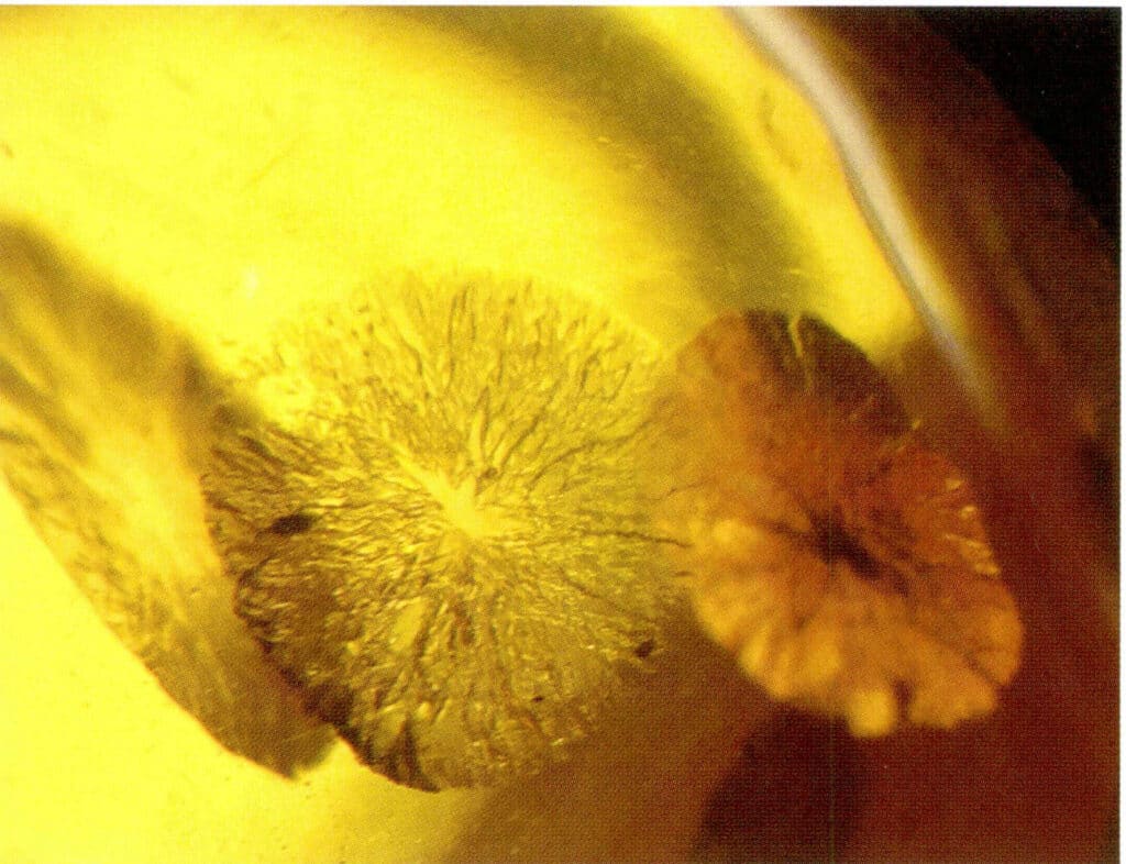 Figure5-5-15 "Sunshine" in Gold Flower Amber (20x) (II)