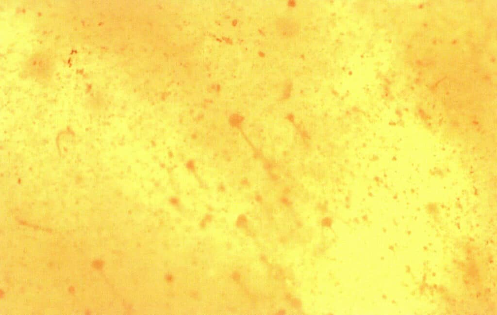 Figure 5-5-38 Microstructure of pressed Amber (30 x ) (VI)