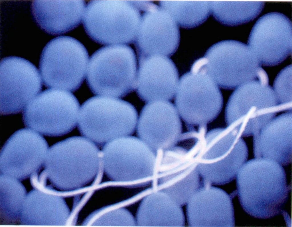 Figure 1-2-37 Freshwater cultured pearls whitened by light (under ultraviolet short wave)