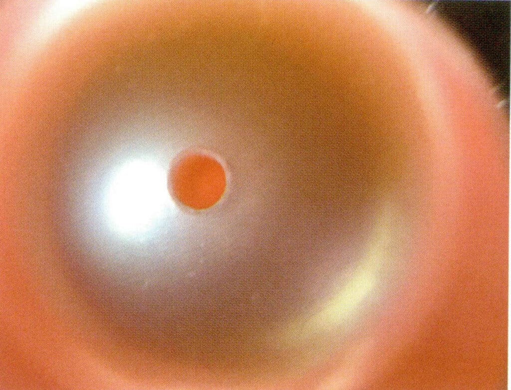 Figure 1-2-52 Microscopic observation of non-nucleated pearls