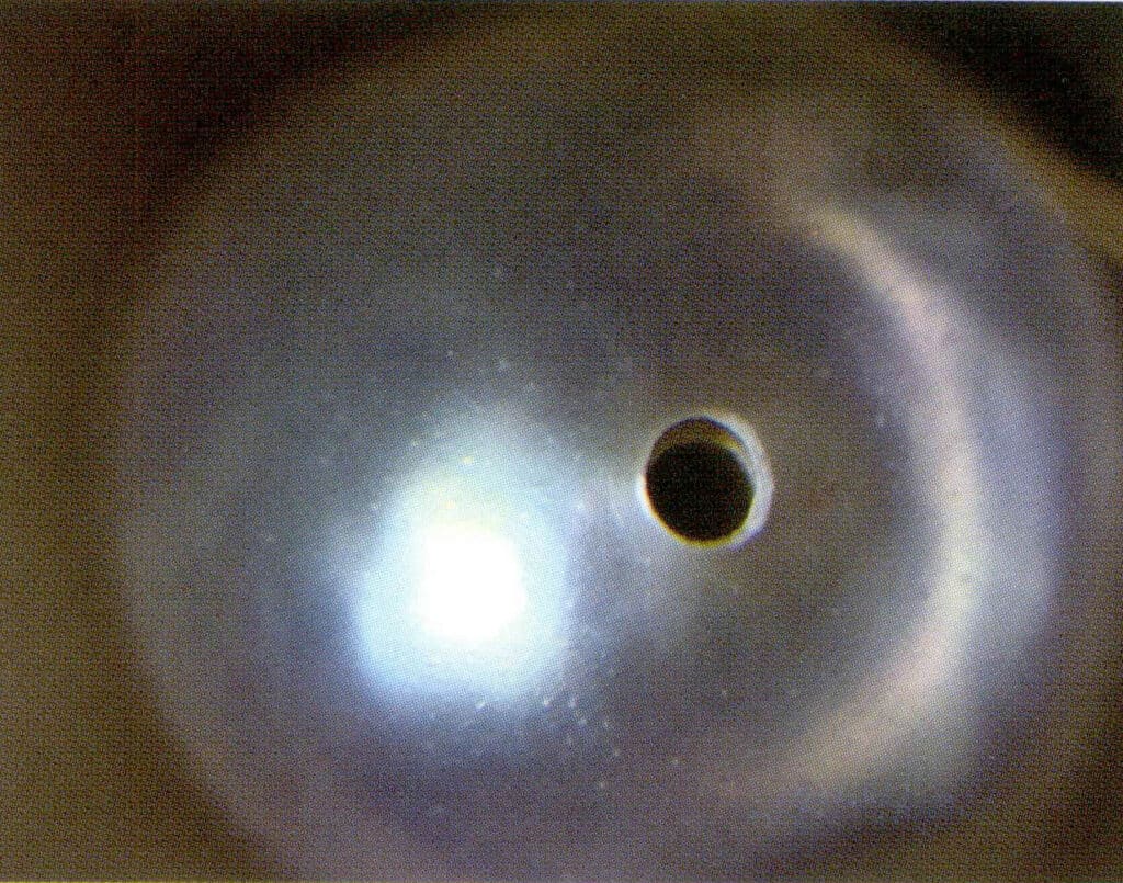 Figure 1-2-54 Microscopic observation of the drilled area of nucleated cultured pearls showing the pearl nucleus and layered structure