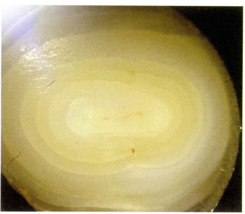 Figure 1-2-66 The concentric layered structure of the nacre layer