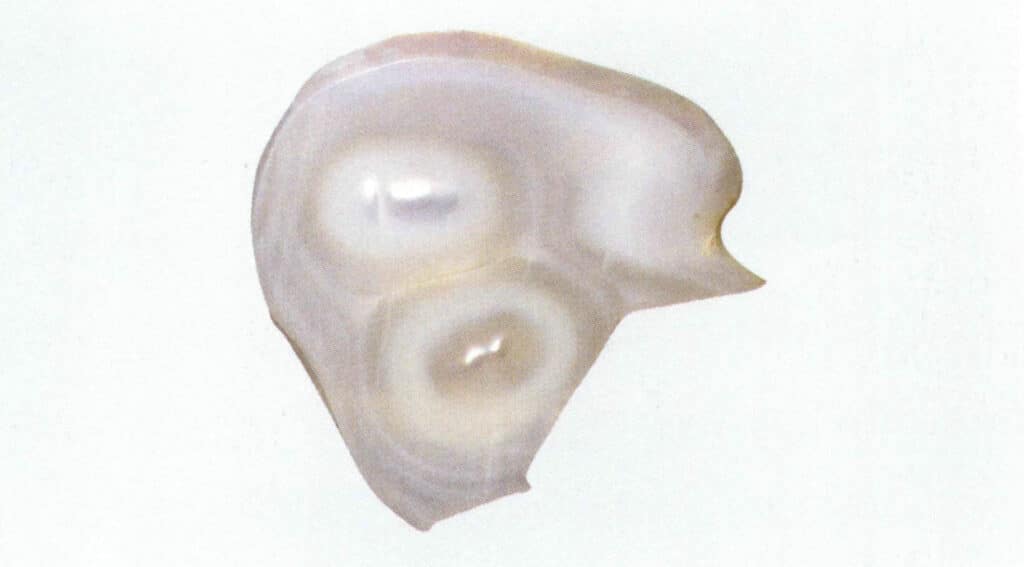 Figure 1-2-70 Concentric layered structure of non-nucleated connected pearls (1)