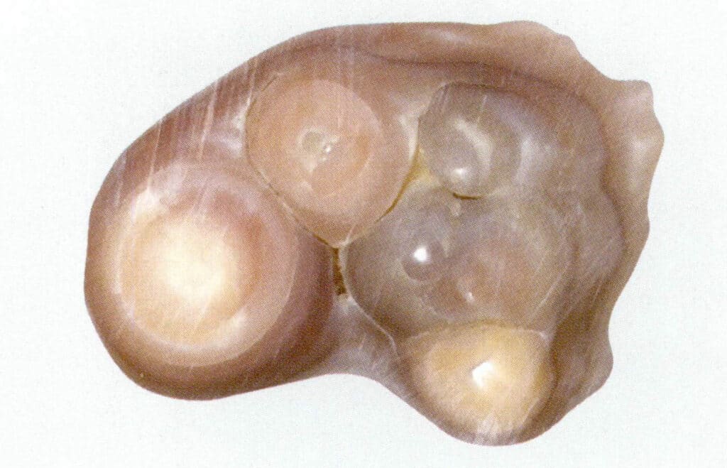 Figure 1-2-71 Concentric layered structure of non-nucleated cultured pearl layers (2)