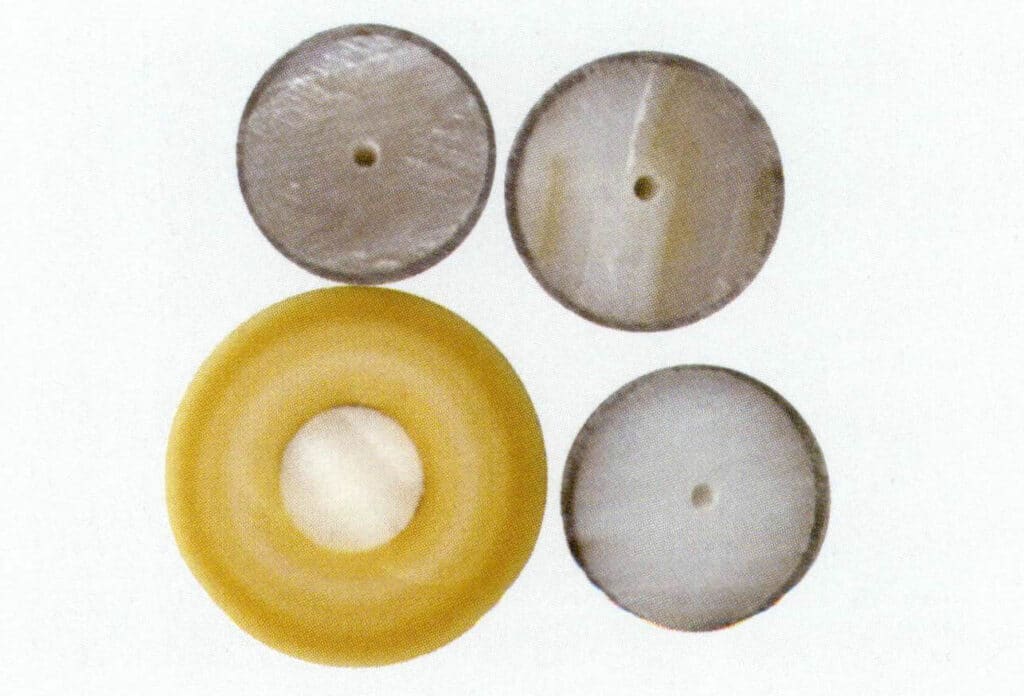 Figure 1-2-73 Structure of nucleated cultured pearls (2)