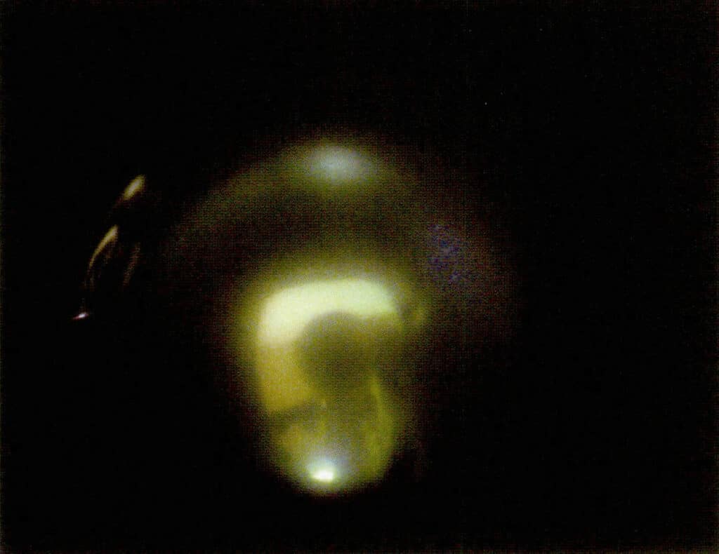 Figure 1-2-79 Black seawater cultured pearls under cathode ray excitation