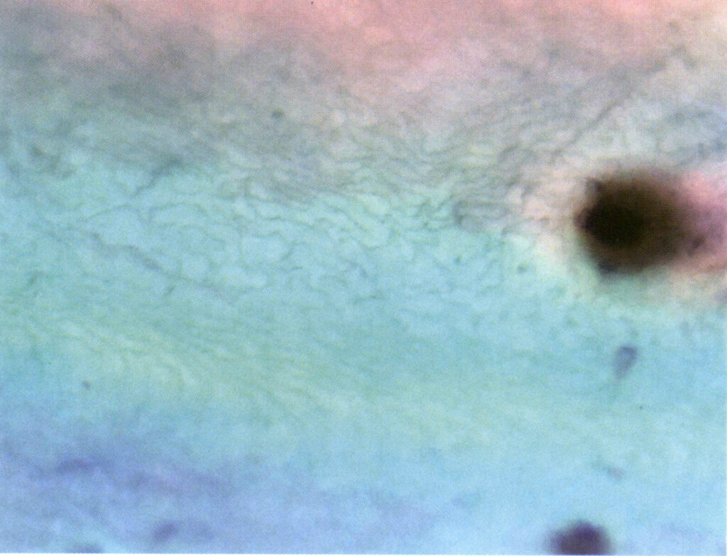 Şekil 4-1-18 İncilerin yüzey büyüme desenleri ve yanardönerliği