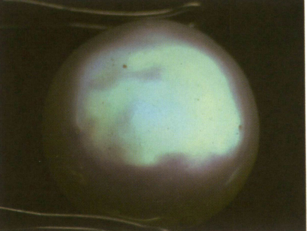 Şekil 4-2-10 Genel yanardönerliğe sahip inciler.