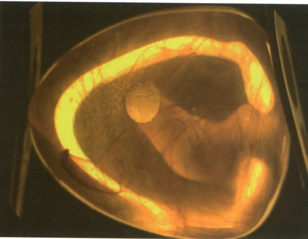 Şekil 4-2-44 Plastik Akış Desenleri (Karanlık Alan Aydınlatma Yöntemi, 10X)