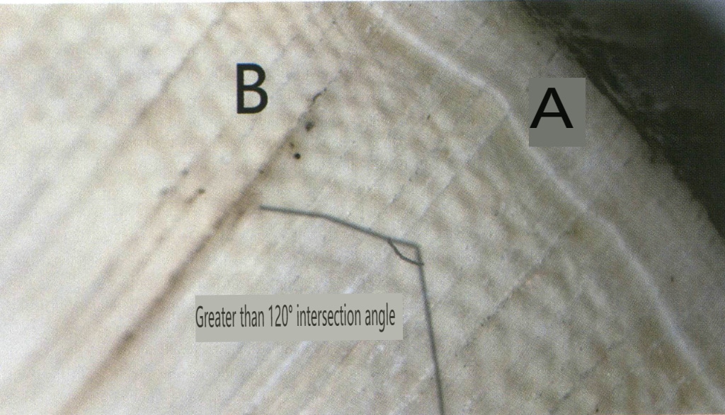 Şekil 4-3-21 Kaba ve seyrek fildişi tabakası açısı 120°'den büyüktür.