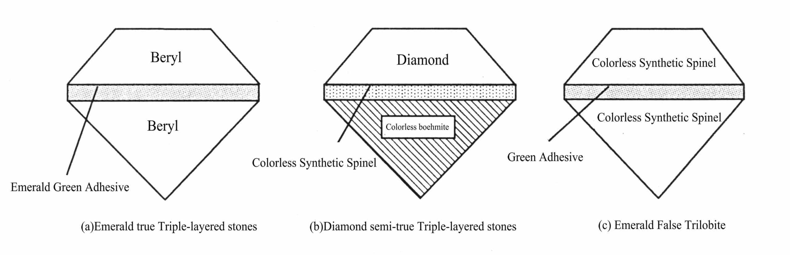 Figure 4-2 Types of Triple-layered stones