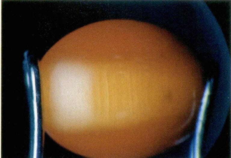 Figure 1-46, the cat's eye effect of glass cat's eyes