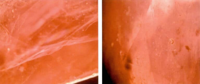 Figures 5-6 show the iridescent interference colors and bubbles of the oil or resin at the filling site under magnification