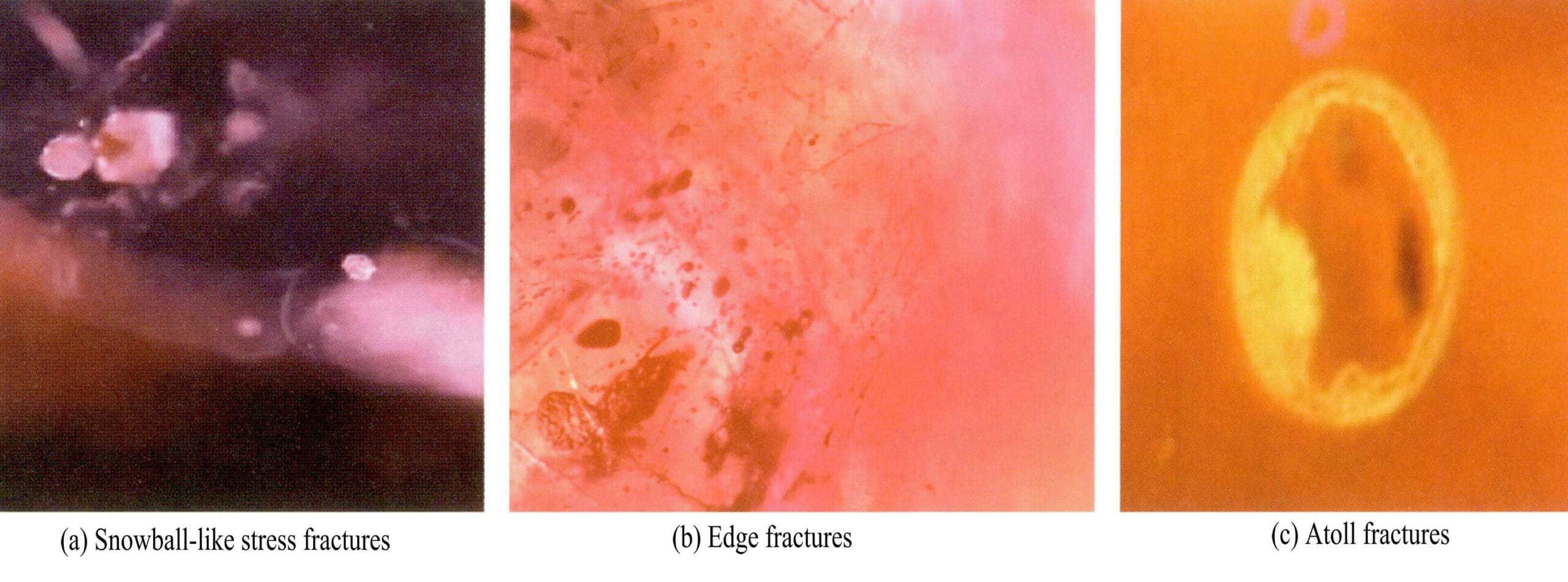Figure 5-10 Characteristics of heat treatment stress fractures